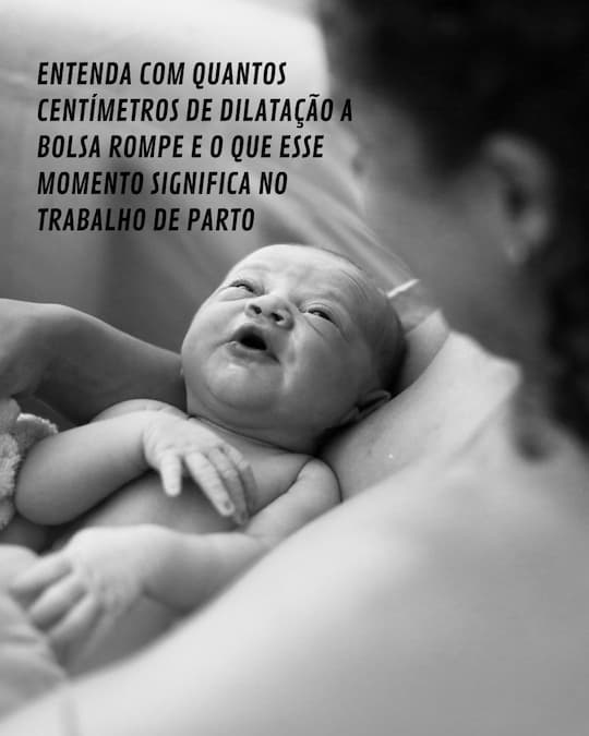 Com quantos centímetros de dilatação a bolsa rompe? Entenda